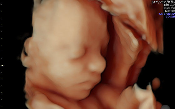 HD live™ Technologies