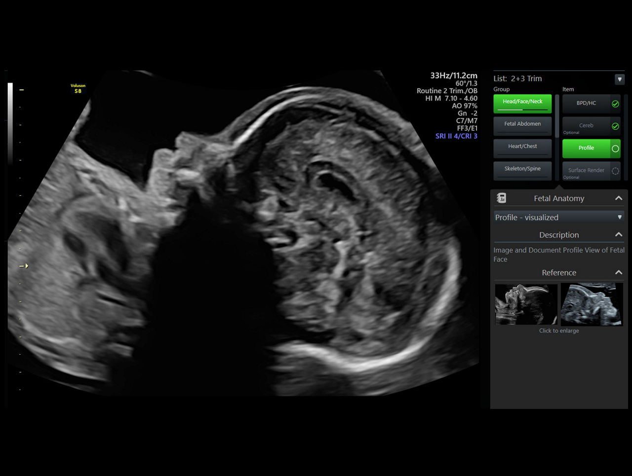 technology-scan-assist