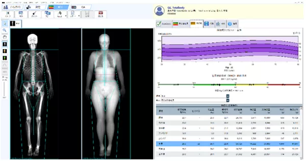 DXA法における体組成計測