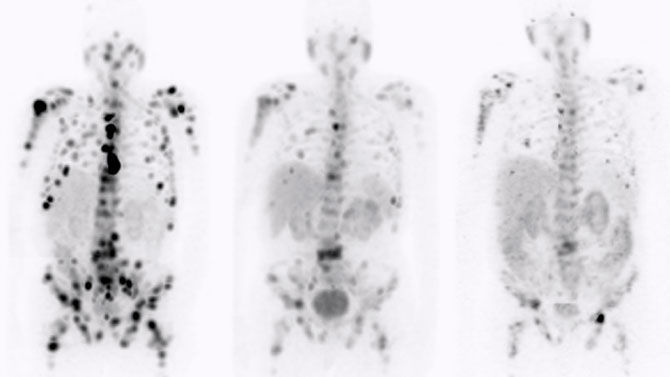 Theranostics-06RelatedContent