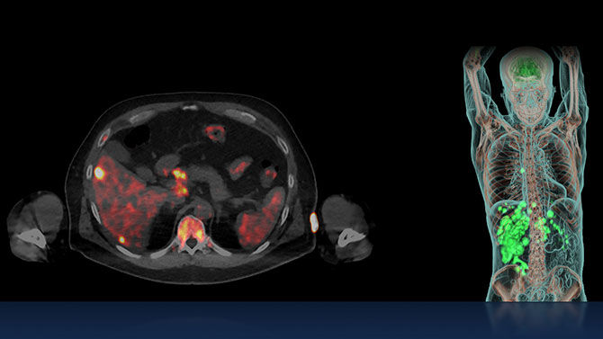 Theranostics-07RelatedContent