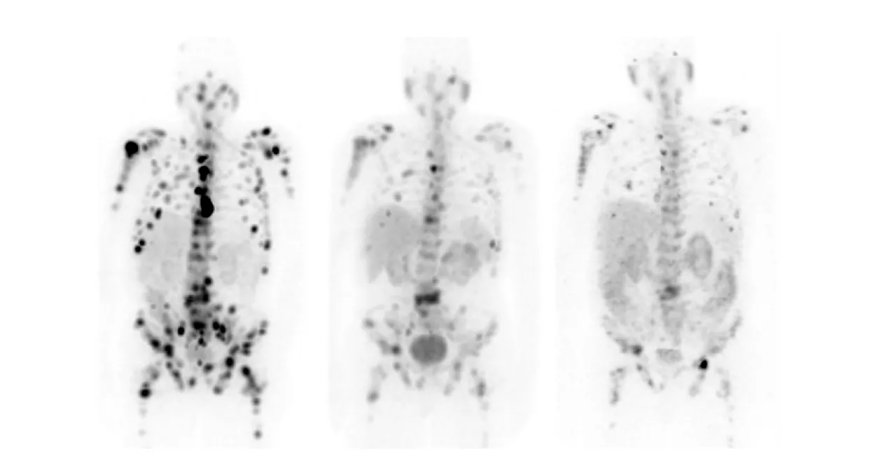 Theranostics-06RelatedContent