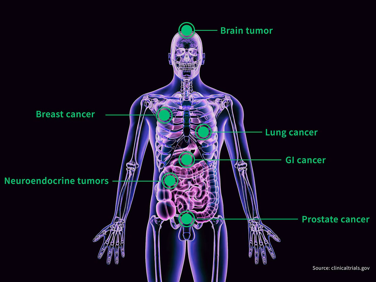 theranostics-scurve3-ci-en