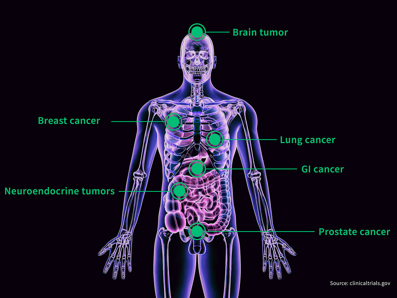 TheranosticsSCurve03-1440x1080