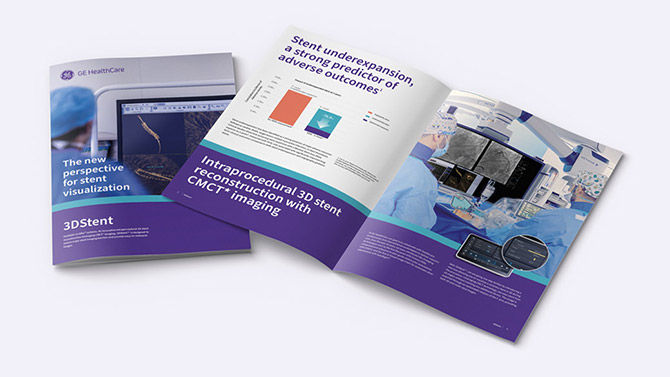 thumbnail_3DStent_670x377