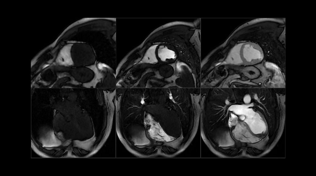 Time-Course-with-MoCo1040-x-585