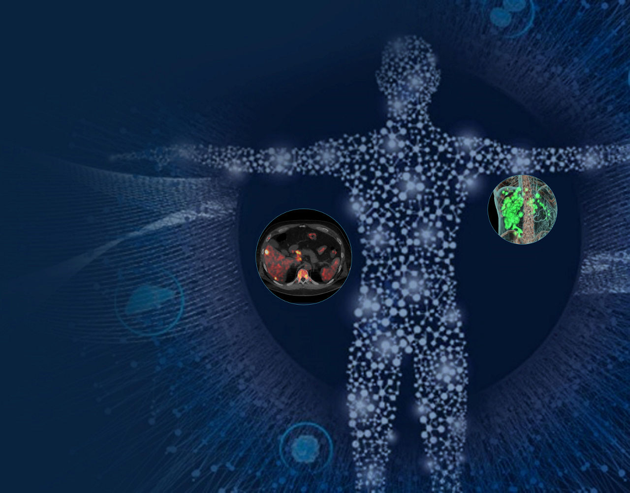 total-mi-for-theranostics-article-image