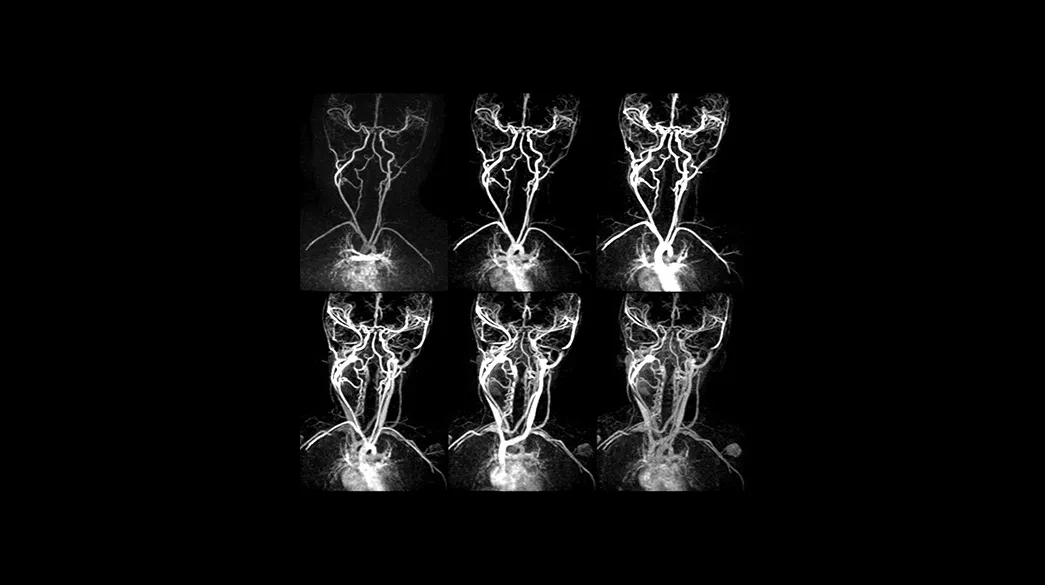 TRICKS1040-x-585