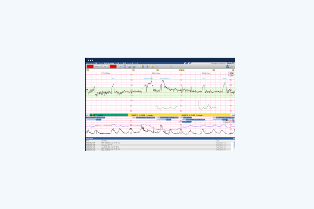 trium-ctg-doku-screen
