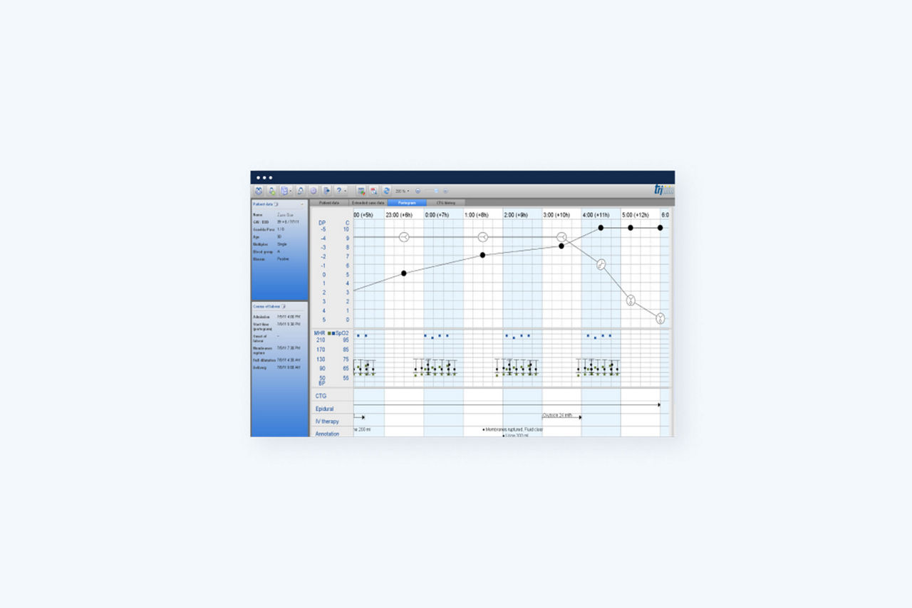 trium-ctg-doku-screen2