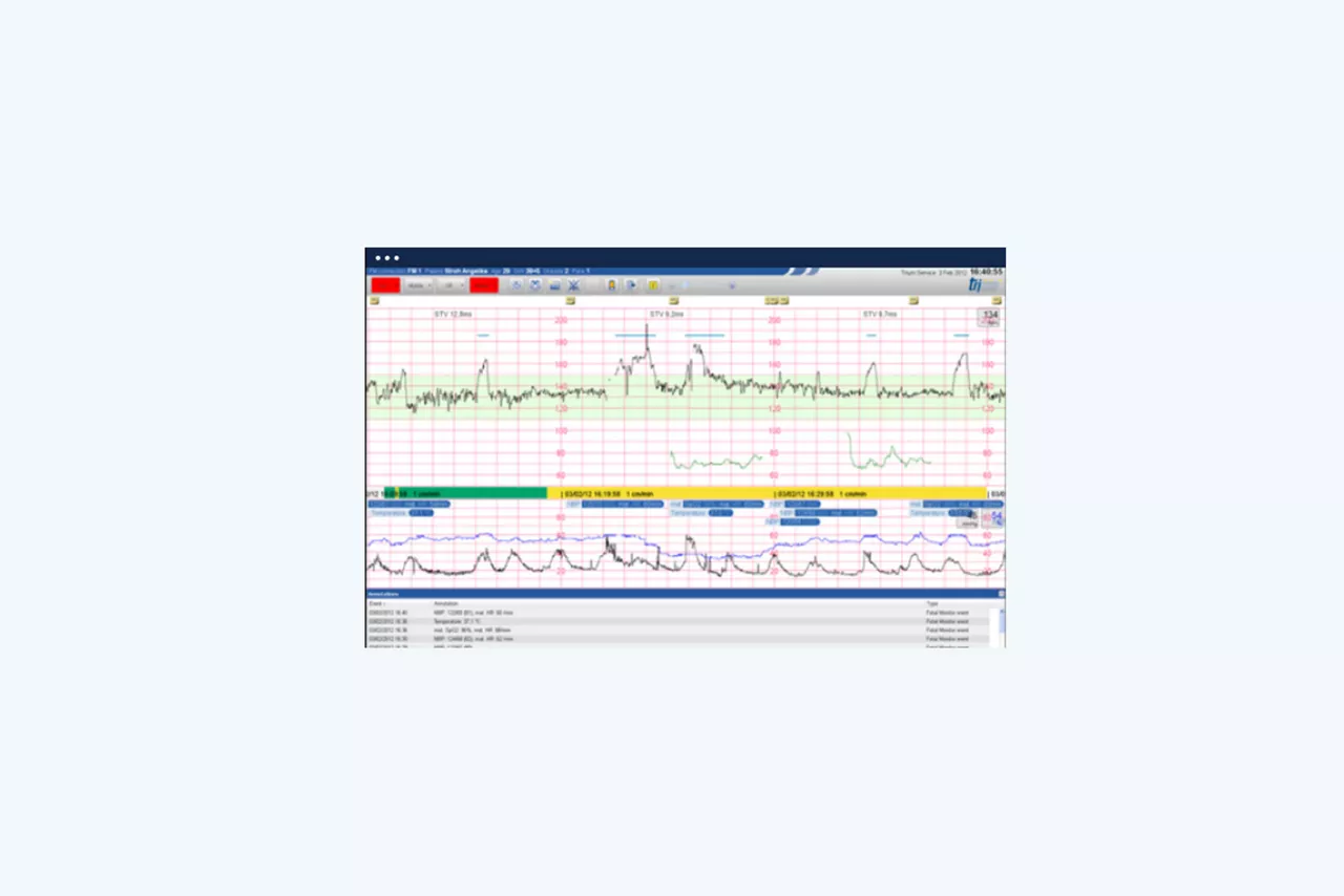 trium-ctg-doku-screen