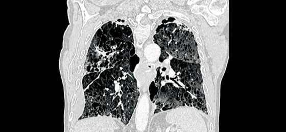 TrueFidelity 560x260