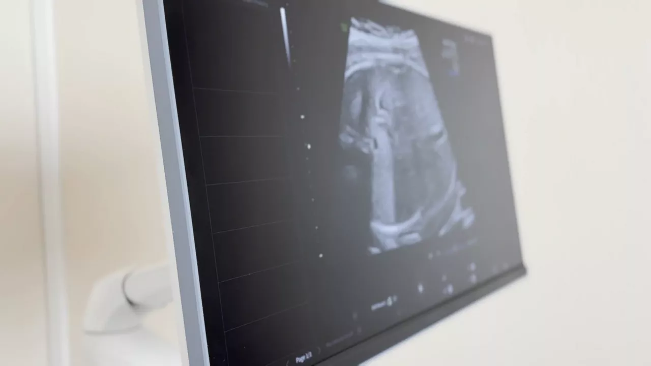 tutorial1-your-trusted-ai-ultrasound-assistant