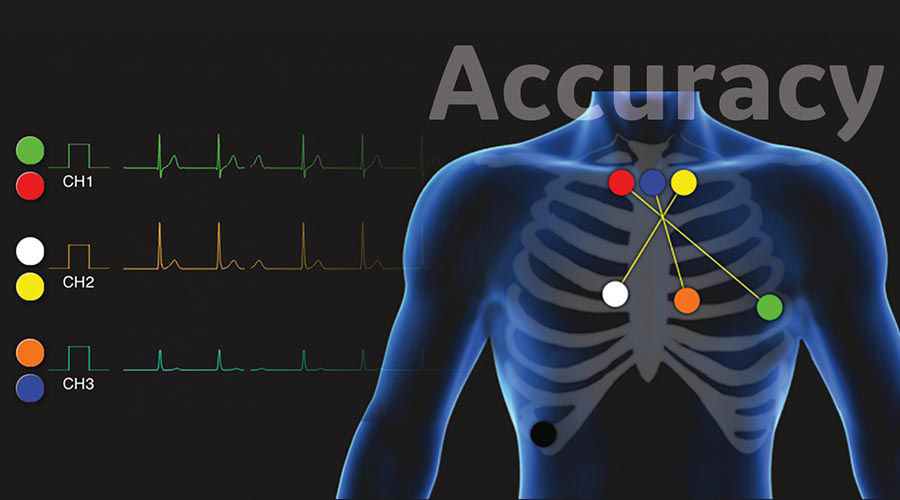 uk images-products-categories-diagnostic-cardiology-cardio update-accuracy.jpg