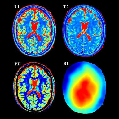 uk images-products-categories-mri-signa pioneer-img 2.jpg
