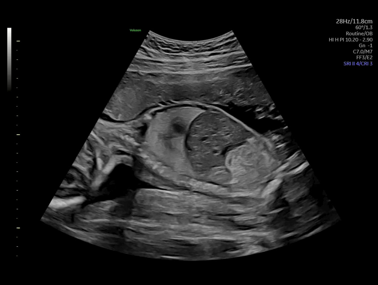 Ultra-HD-clinical-image
