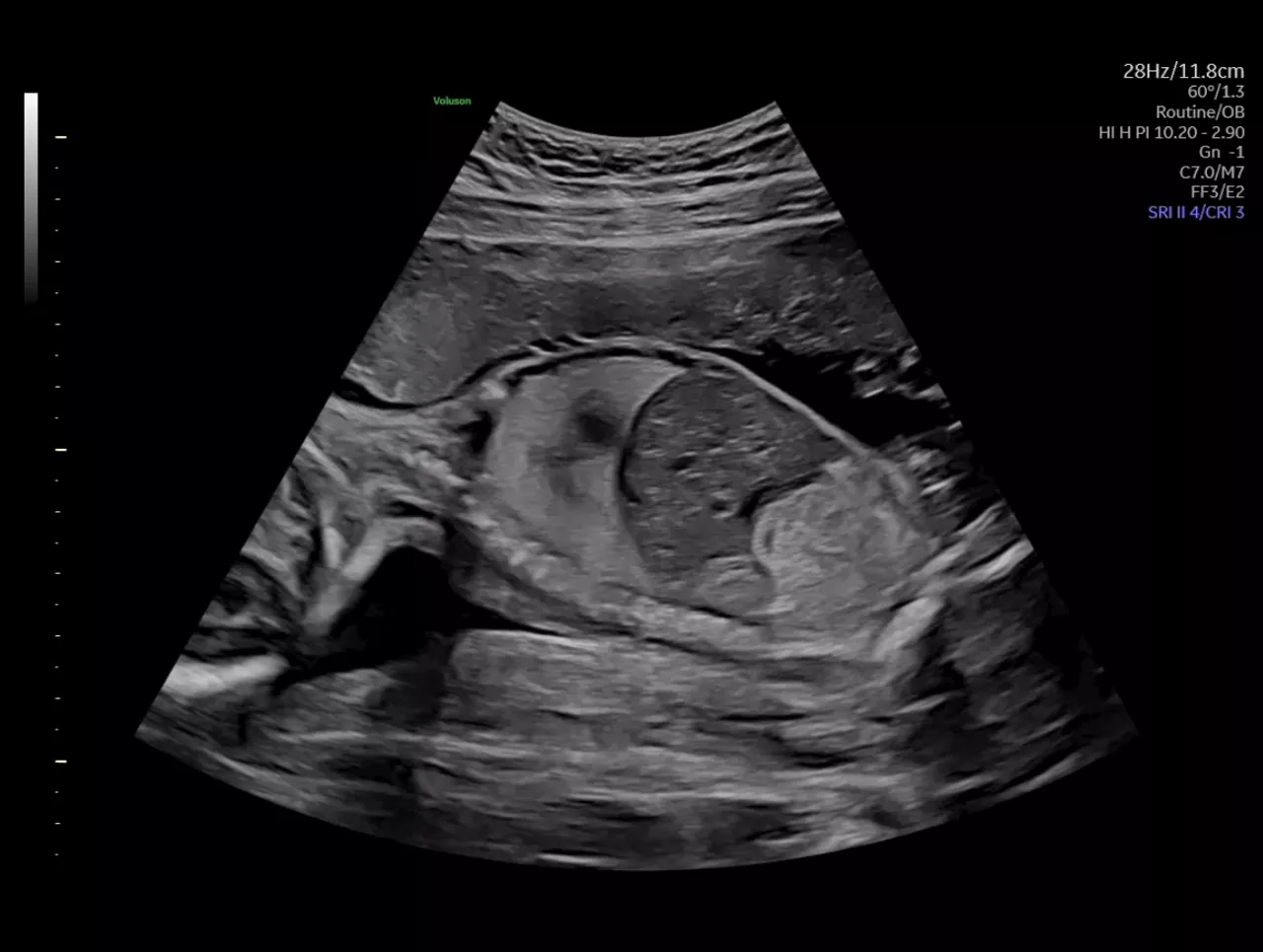 Ultra-HD-clinical-image