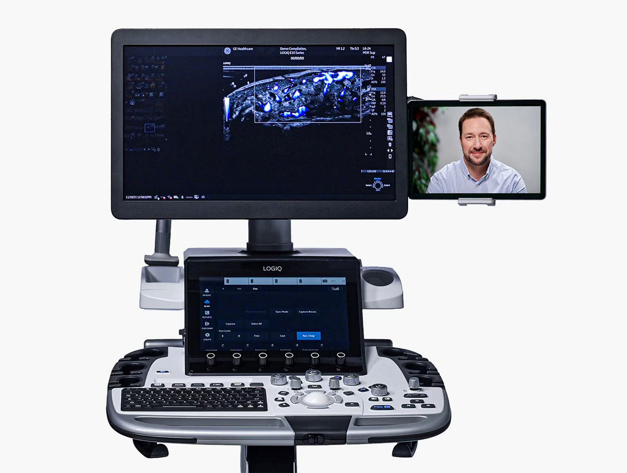ultrasound-digital-collaboration-scruve-peer-collaboration-ci-en