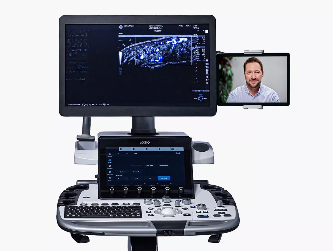 ultrasound-digital-collaboration-scruve-peer-collaboration-ci-en