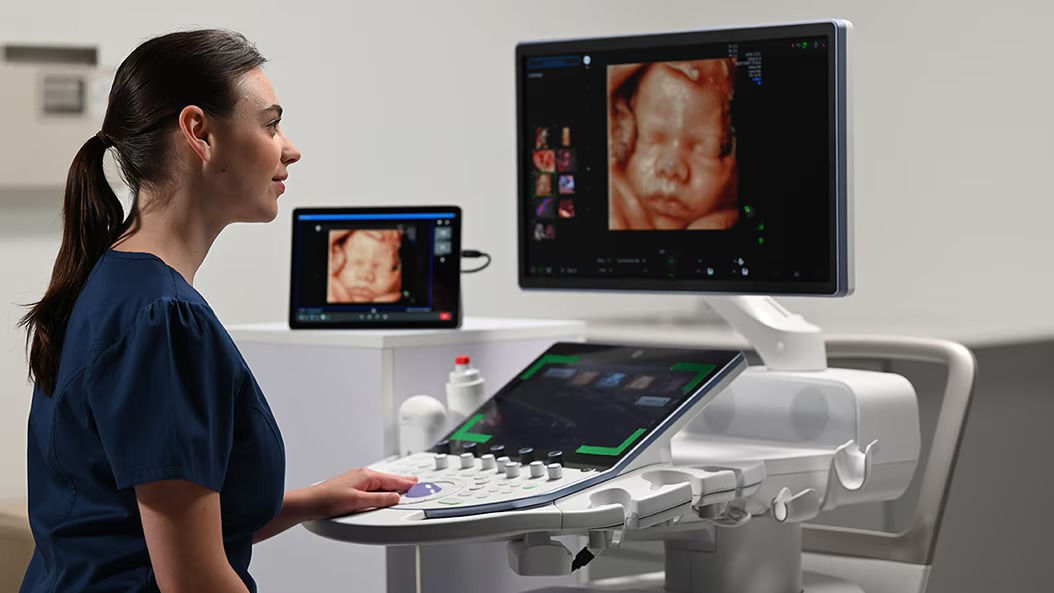 ultrasound-digital-collaboration-tabs-womens-health-ci-en