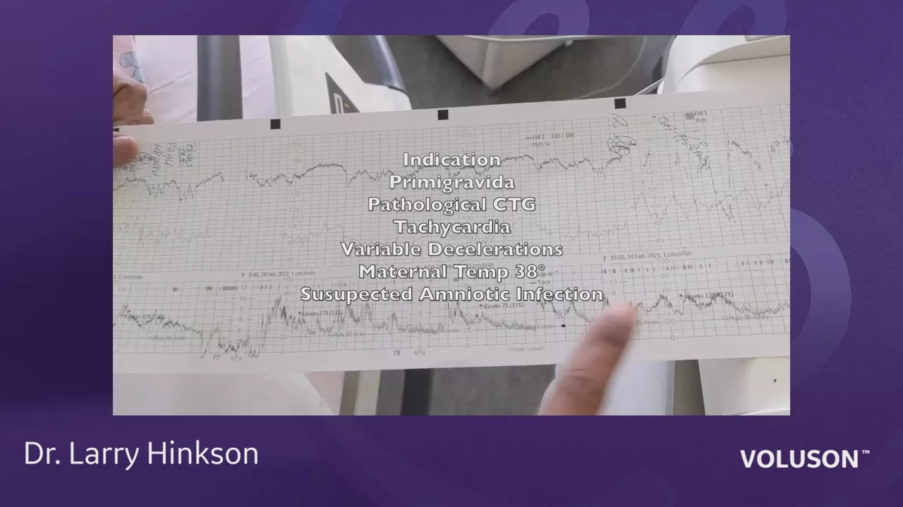 ultrasound-in-labor-and-delivery-dr-hinkson