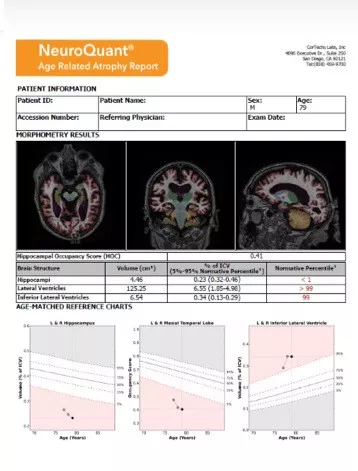 ultrasound-signaarchitect-clinicalimages-imageworks-NeuroQuant