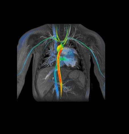 product-product-categories-ultrasound-signa architect-clinical images-viosworks-viosworks.jpg