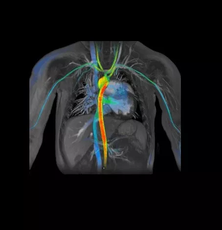 product-product-categories-ultrasound-signa architect-clinical images-viosworks-viosworks.jpg