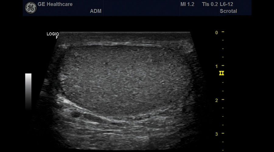 ultrasound-urology-sagittal-testicle