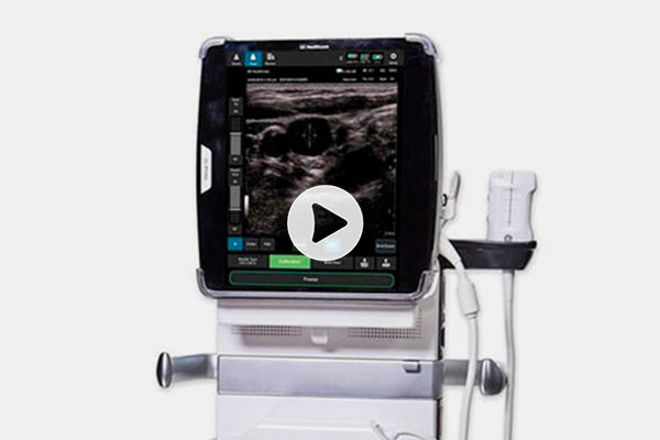Venue 50 Point of Care Ultrasound