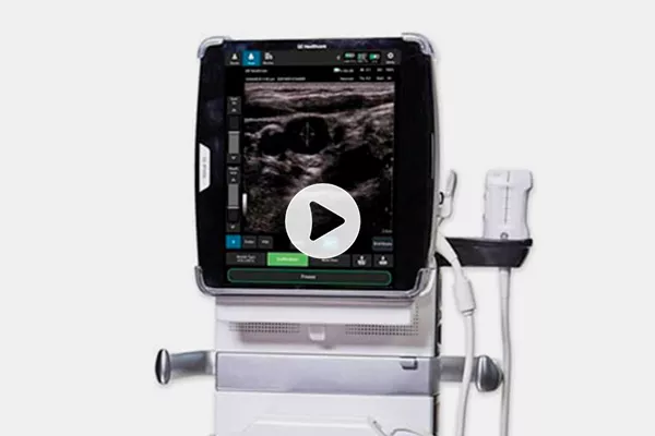 Venue 50 Point of Care Ultrasound