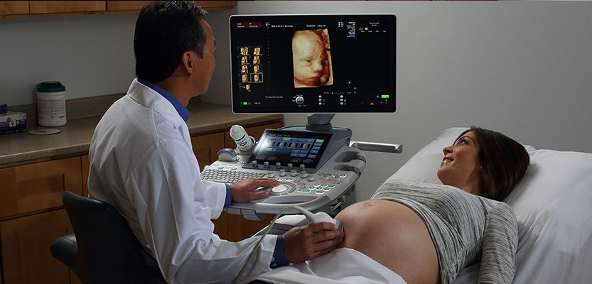 ultrasound-voluson