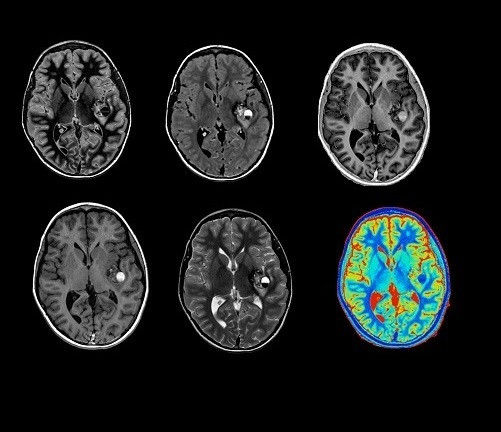 product-product-categories-ultrasound-signa architect-clinical images-imageworks-ImageWorksfinal1.jpeg