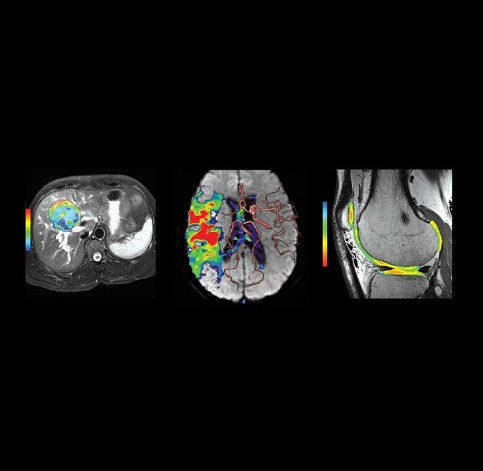 product-product-categories-ultrasound-signa architect-clinical images-imageworks-ImageWorksfinal2.jpeg