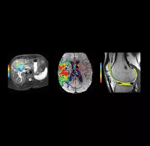 product-product-categories-ultrasound-signa architect-clinical images-imageworks-ImageWorksfinal2.jpeg