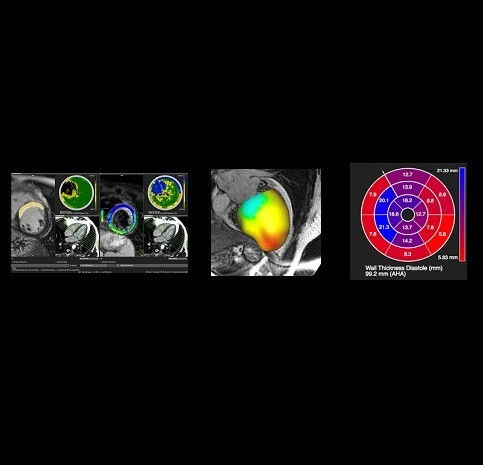 product-product-categories-ultrasound-signa architect-clinical images-imageworks-ImageWorksfinal3.jpeg