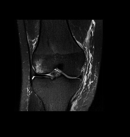 product-product-categories-ultrasound-signa architect-clinical images-silentworks-silent_knee-cor.jpg