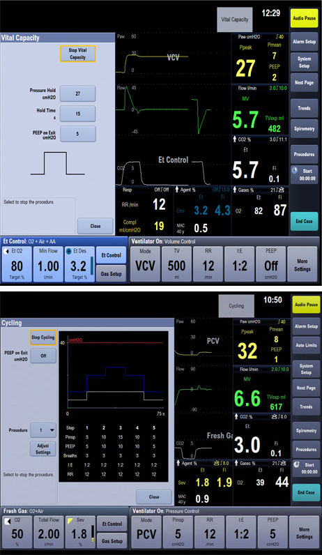uncomp-ventilation-flow-power_new