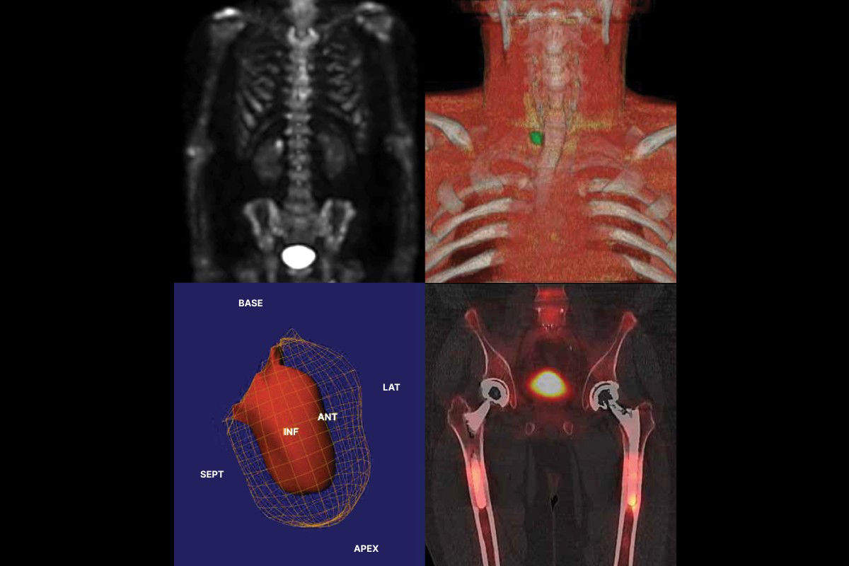 unlock-the-potential-of-theranostics