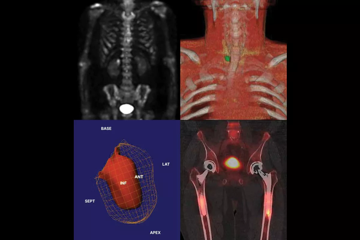 unlock-the-potential-of-theranostics