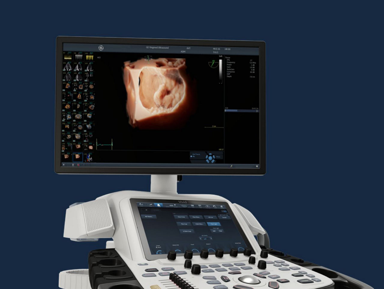 upgrade-update-s-curve-desktop-st-en