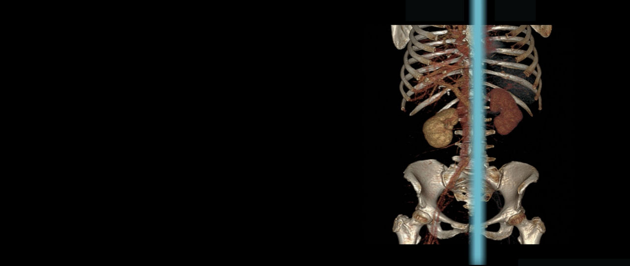 upgrades-and-options-hero-1920x810-ba-en