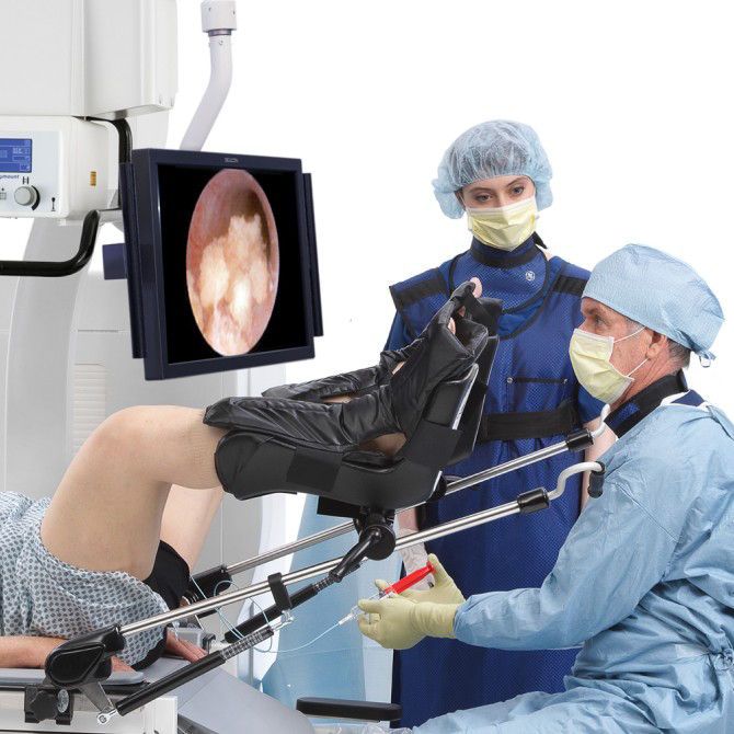 c-arms-for-urology-surgery