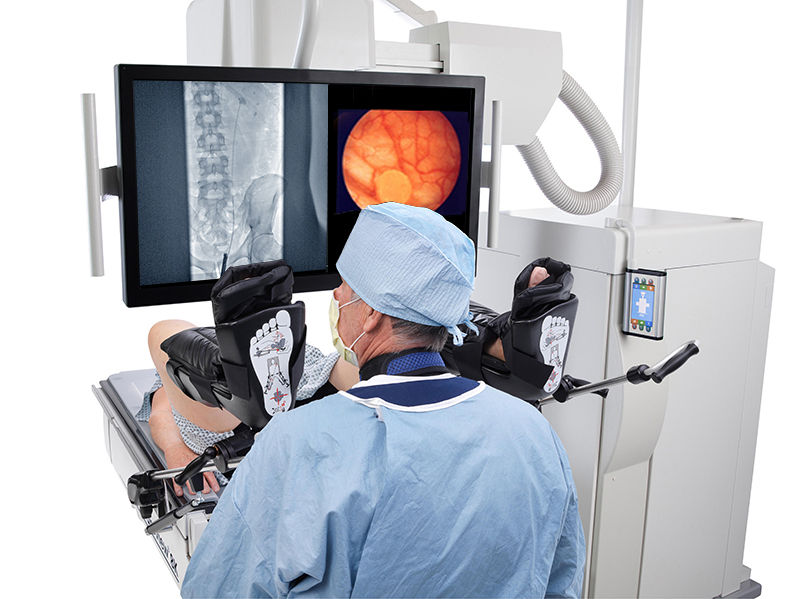 Uroview 8K_benefits