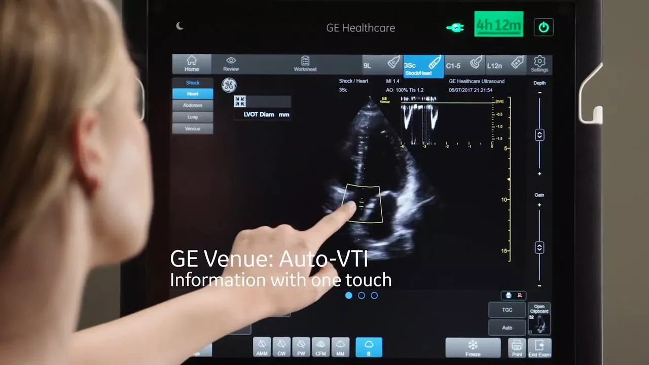 value-of-auto-vti