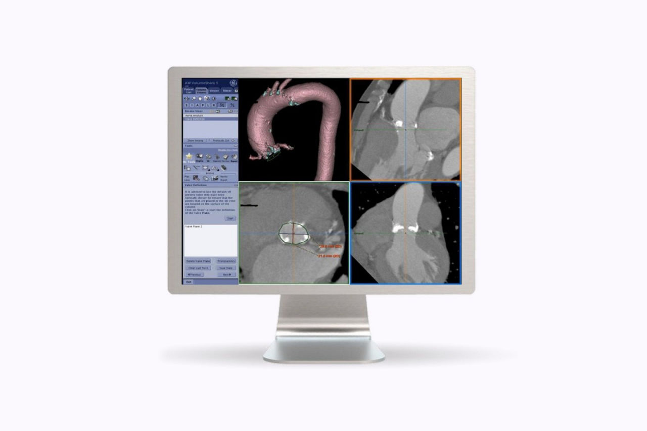 value-planning-highlights-ci-en