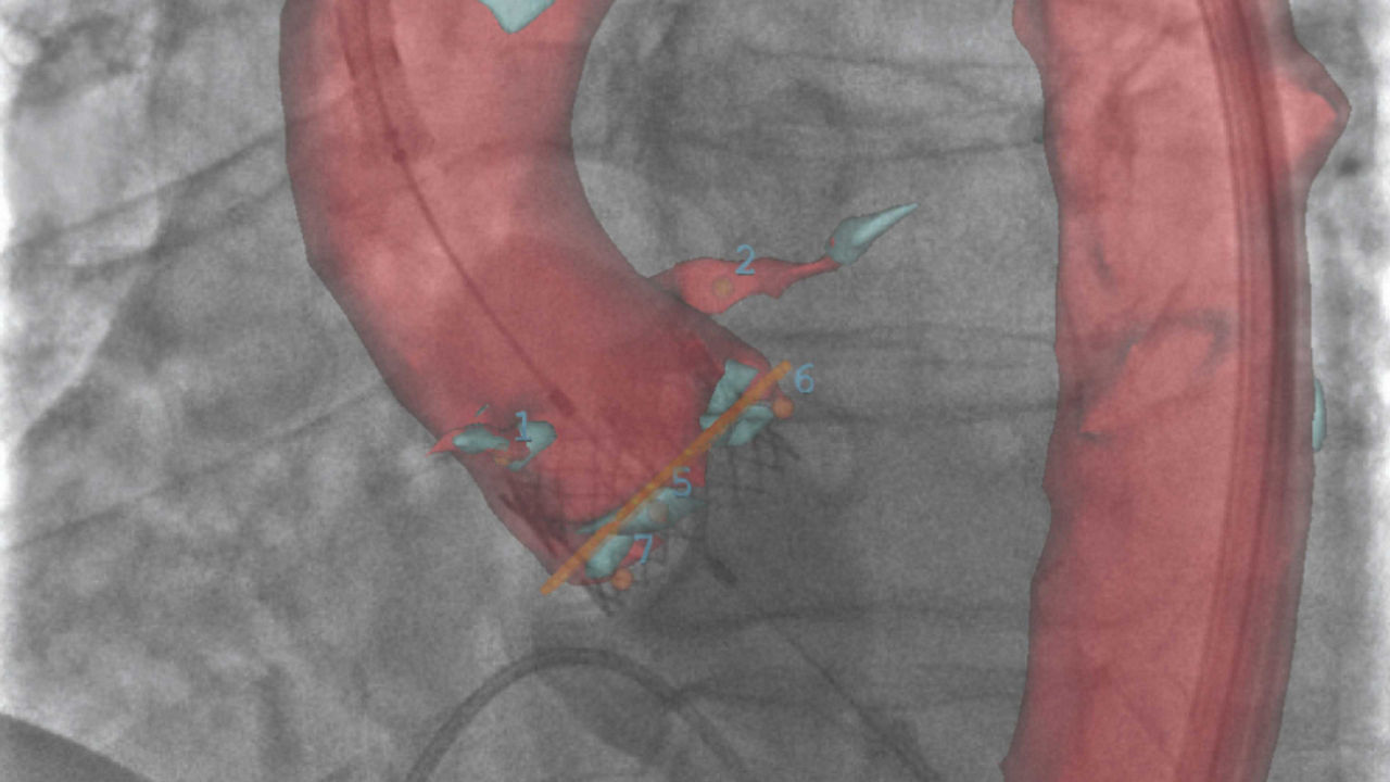 CARESCAPE spirometry accessory.