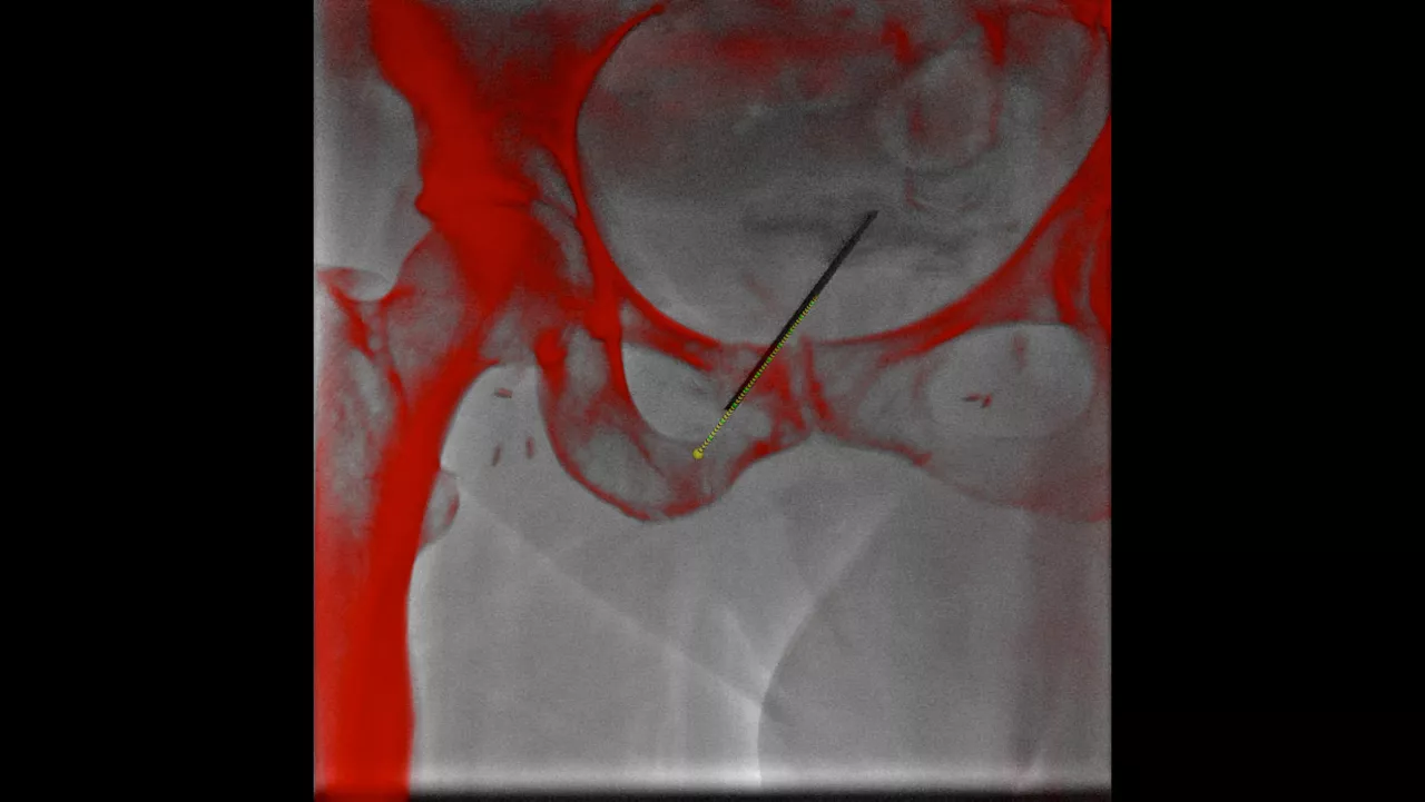vanced-visualization-applications-innova-trackvision-clinical-aw-trackvision-clinical4