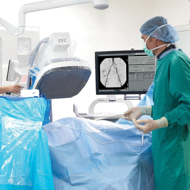 c-arms-for-vascular-surgery