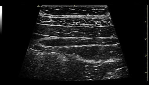 venue-point-of-nerve-block-card2-ci-en